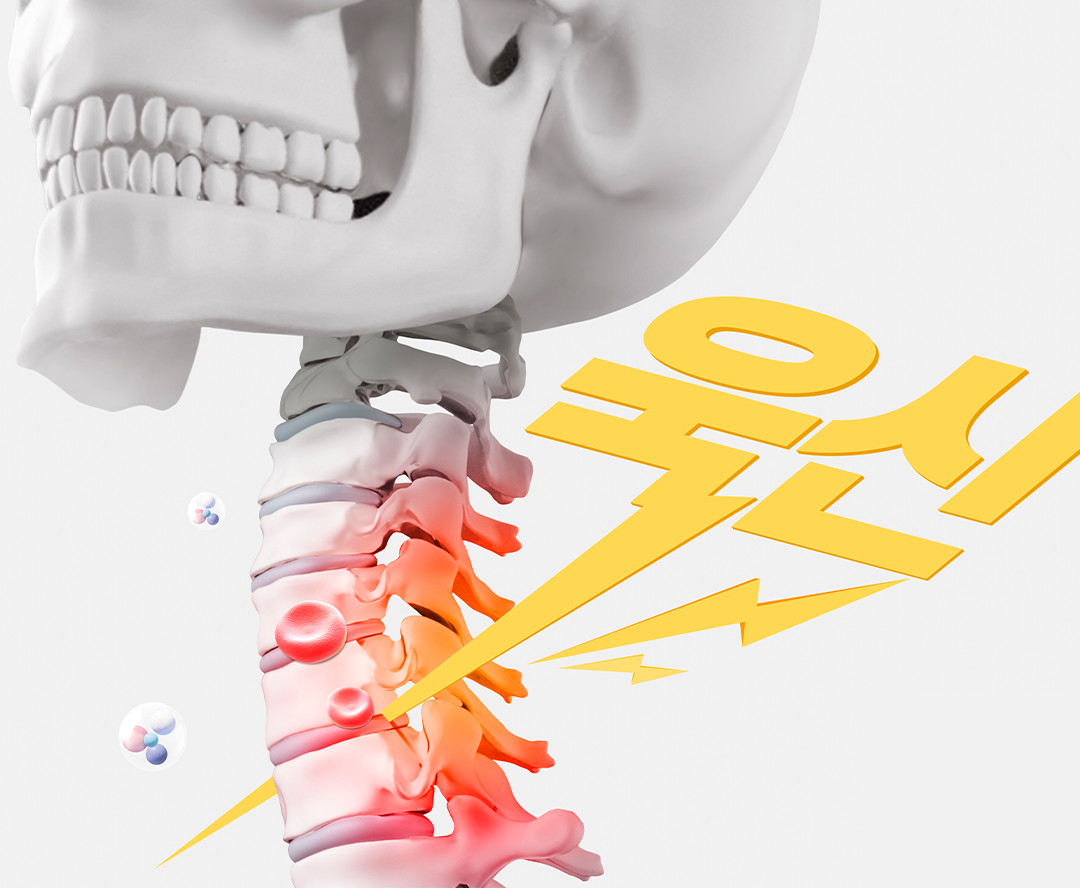 목뒤 번쩍한 느낌, 목디스크 초기증상과 신경감압 치료법, 1포탈척추내시경 추천이유
